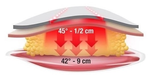 Body warm electro remodelage - Institut by Scarlett - Belgique - Braine l alleud - infrarouge