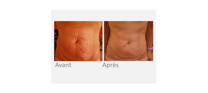 Ondadinamica corps - ventre - Institut by Scarlett