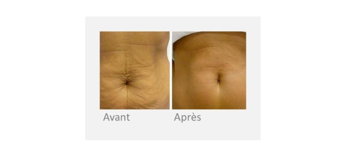 Ondadinamica corps - ventre - Institut by Scarlett