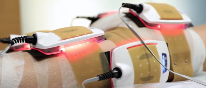 Soin corps synergie laser 980 nm - institut by Scarlett - Belgique - Braine l'Alleud - piece à main installés