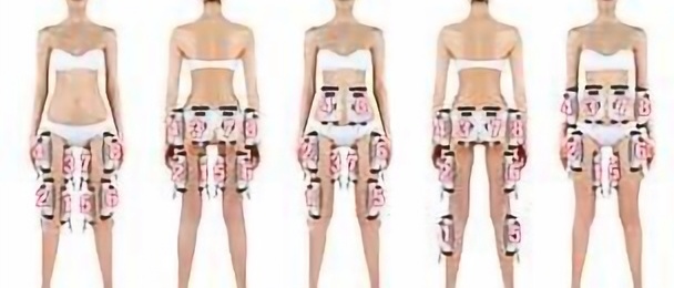 Soin corps synergie laser 980 nm - traitement corps - Institut by Scarlett