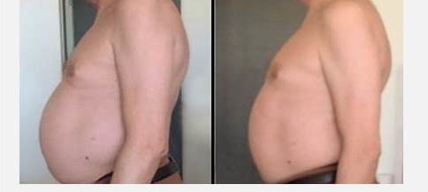 X-magic ventre homme - Institut by Scarlett