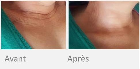 X-skin age cou decollete - Institut by Scarlett