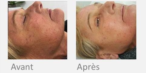 X-skin age femme - Institut by Scarlett