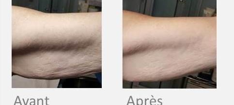 x-magic bras - Institut by Scarlett